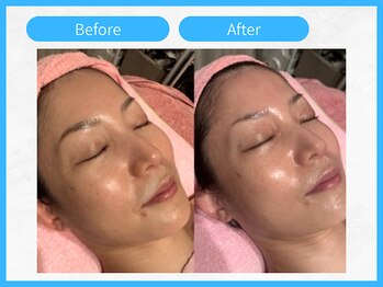 トウメイコガオ 横浜店/トウメイコガオでハーブ