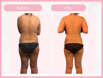 アールエイチビー 藤沢店(RHB)/