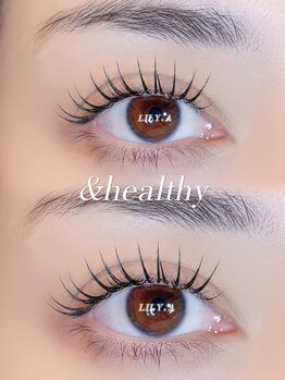 リリア(LILY.A)の写真/【&healthy】マツエク×パーマで、下がりまつげを根元からリフトアップ★
