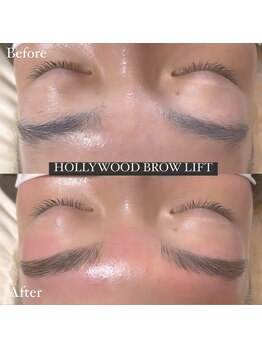 フリル(FRILL)/《HOLLYWOODBROWLIFT》