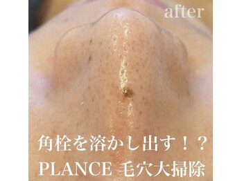 プランス 渋谷店(PLANCE)/毛穴お掃除オプション！