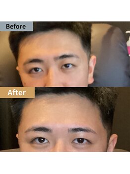 眉毛ハウス 吉祥寺店(眉毛HOUSE)/お客様の施術例(吉祥寺/東京)