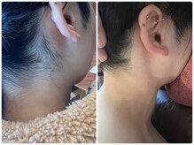 チャム(cham)の雰囲気（うなじ/背中/VIO脱毛増加中！ケアが難しいパーツはプロにお任せ）