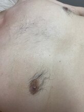 サロンアンドスクール ローズマリー (Salon&School Rosemary)/男性のブラジリアンワックス可能