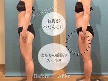 ピュアエステブリアント 銀座店/お客様の結果［銀座/痩身］