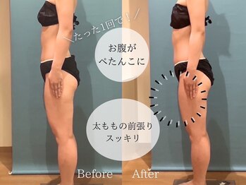 ピュアエステブリアント 銀座店/お客様の結果［銀座/痩身］