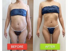 ティアランジュ 米子店(Tiarange)の雰囲気（"継続率90%超え"痩身メニュー！理想のボディまで徹底サポート！）