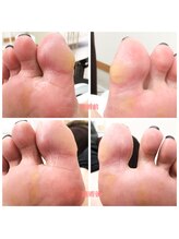 ココネ(cocone)/スペシャルフットケア