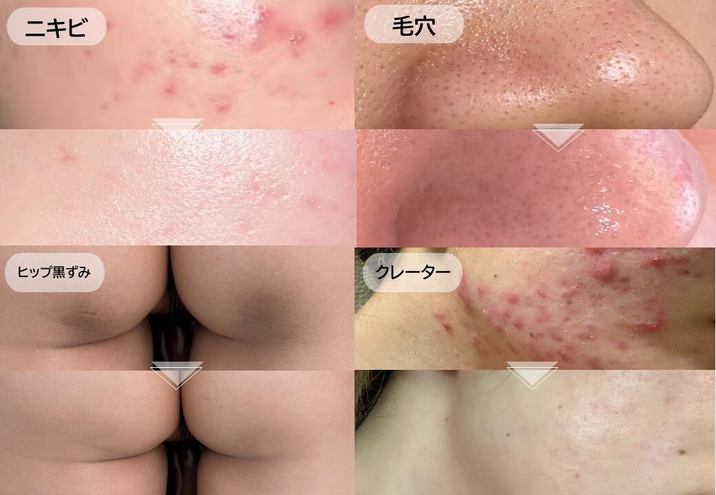 麻布十番駅で光フェイシャルが人気のエステサロン｜ホットペッパー