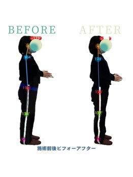 アティチュード 高崎(ATTITUDE)/姿勢が悪いのがコンプレックス