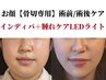 お顔骨切り専用★術前/術後インディバ+腫れケアLEDライト60分¥16500→¥12900