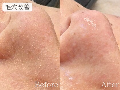 サロン ド ペオニー 川内店(salon de peony)の写真