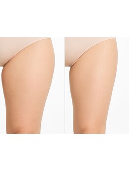 太モモ・ヒップまわりをケアしたい