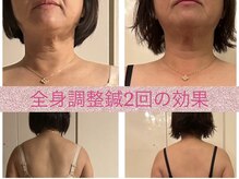 フェルーシュ鍼灸 銀座(Feruche)