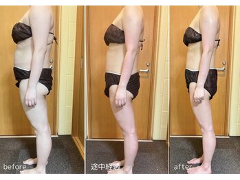 アンドワイ バイ サロンリーナ(&y by Salon Lena)/【深層汗腺リンパマッサージ】