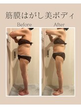 ナナイロ(nanairo)/筋膜リリースビフォーアフター