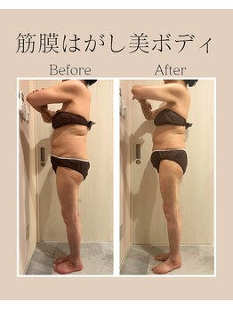 ナナイロ(nanairo)/筋膜リリースビフォーアフター