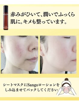 ララスマイル 鶴崎森町店/お肌改善プログラム(肌荒れケア)