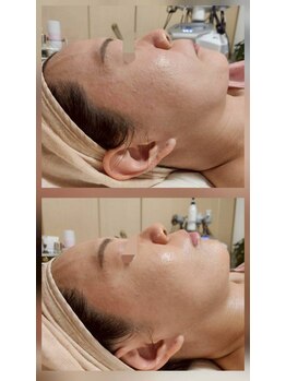 ロータスマップ(LOTUS MAP)/