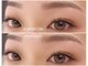 アナスター(ANASTAR)の写真