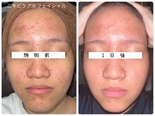 ルル 西八王子店(LuLu)