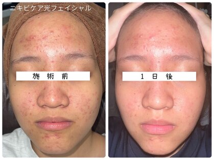 ルル 西八王子店(LuLu)の写真