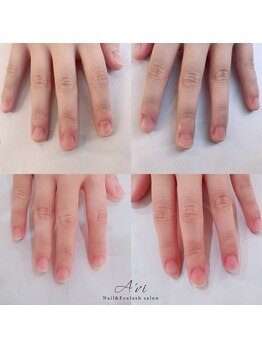 ネイルアンドアイラッシュ アヴィ(Nail and Eyelash A'vi)/自爪育成コース