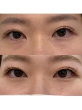 アイラッシュサロンナチュレ(NATURE)/まつ毛美容液