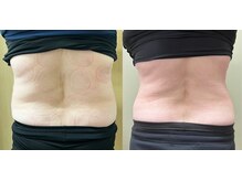 ココア(CoCoa)/パーソナルトレーニング