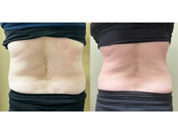 ココア(CoCoa)/パーソナルトレーニング