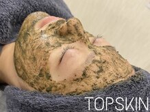 トップスキン 新宿(TOPSKIN)/肌質改善ならハーブピーリング♪