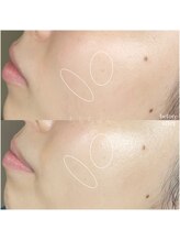 ちらちゅら/イラストリアス