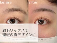 ソイル(soil)/施術