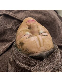 リッチ(Rich)の写真/本気で変わりたい30代以降への革命！見違える透明感とハリ肌を手に入れるハーブピーリング