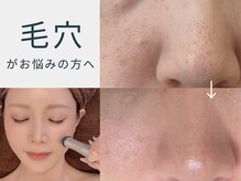 スワン 大阪南堀江(swan)の雰囲気（ピーリング美容液で毛穴洗浄【アクアピール】）