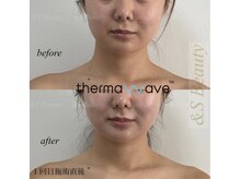 アンドエスビューティ(&S Beauty)/20代から、たるみ予防ケア