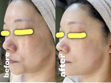 ミコサロン(miko salon)の写真