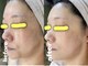 ミコサロン(miko salon)の写真