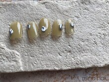 ルテ(rte)/ちぐはぐ