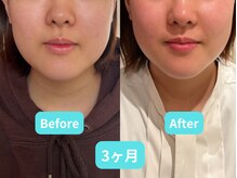 ホープ鍼灸整骨院/10回の施術結果です！