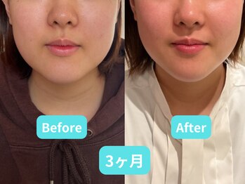 ホープ鍼灸整骨院/10回の施術結果です！