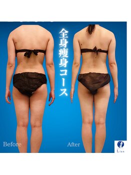 リアン(Lian)/【代謝を上げて痩せたい方！】