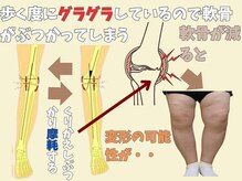 ニコ(niko)/放置してしまうと将来は・・