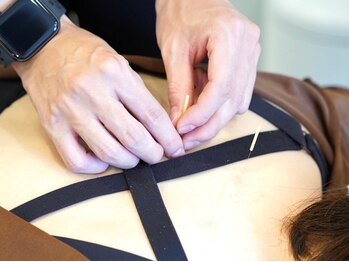 レスト(Rest)の写真/【平日限定クーポンあり◎】整体×鍼で肩こり腰痛などの不調をケア★お悩みに合わせた施術をご提案♪