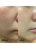 facial【リピート様専用】前回と同じ施術・ルルド駒澤お任せ
