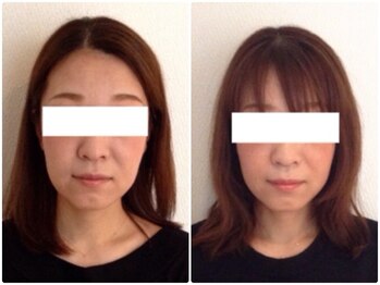 美容整体 ウェリナ 蟹江院/小顔矯正/骨盤矯正/美脚サロン