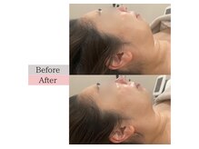 フロリール アザブジュウバン(FlorirAzabujuban)/3D小顔/造顔フェイシャル