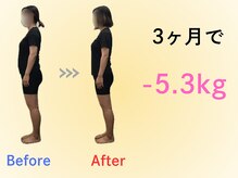 健康工房たいよう整骨院/産後ダイエットBefore After