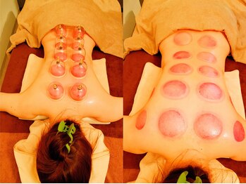 優/カッピング30分+オイル30分