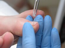 ドクターネイル爪革命 北千住店/巻き爪ケア